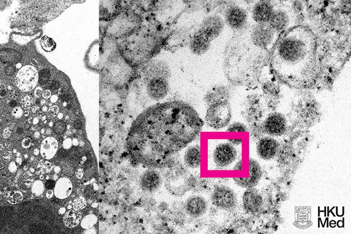 «Омикрон» обнаружили в Томске