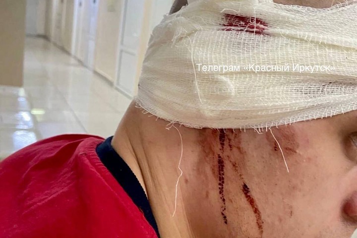 Неизвестный напал на иркутского депутата от КПРФ Неизвестный напал на иркутского депутата от КПРФ