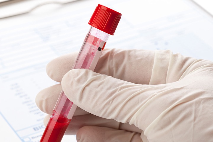 Тест на отцовство, как происходит Тест на отцовство, как происходит