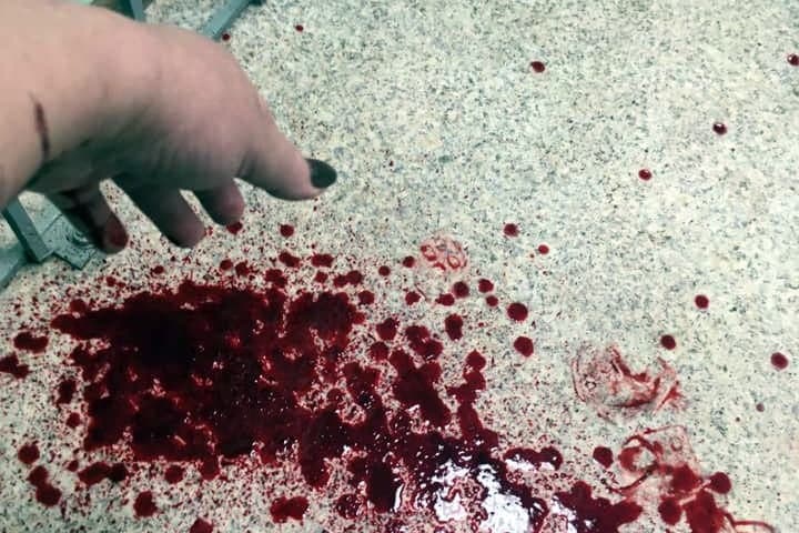 Красноярка порезала себя в суде из-за отказа в приеме у врача