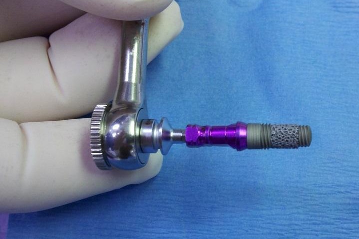 Zimmer импланты