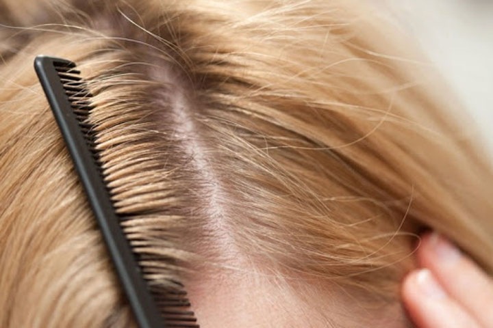 «Гнид направо, вшей налево»: алтайский Роспотребнадзор рассказал о педикулезе в стихах «Гнид направо, вшей налево»: алтайский Роспотребнадзор рассказал о педикулезе в стихах