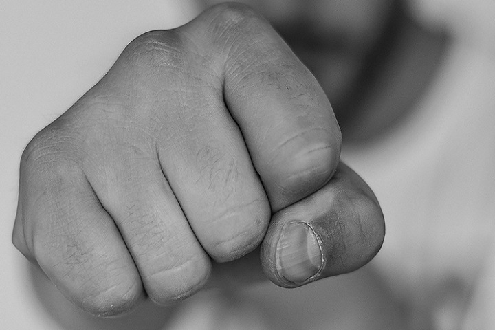 Томич избил стоматолога из-за отказа оформлять больничный лист Томич избил стоматолога из-за отказа оформлять больничный лист