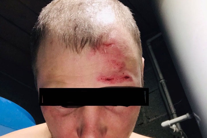 Жители Красноярского края пожаловались на избиение сотрудниками МЧС в день спасателя Жители Красноярского края пожаловались на избиение сотрудниками МЧС в день спасателя