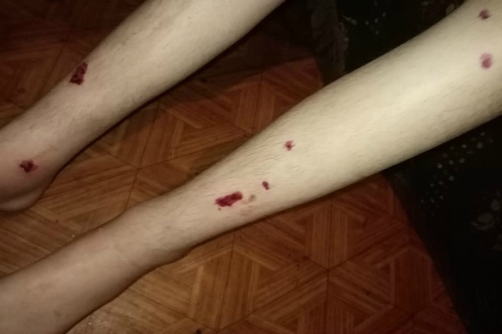 Новосибирский фонд заявил о необходимости разукрупнения интернатов после истязаний ребенка Новосибирский фонд заявил о необходимости разукрупнения интернатов после истязаний ребенка