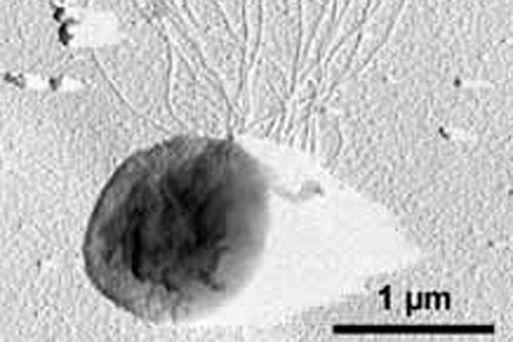 Фермент для эффективной борьбы с раком нашли в сибирской нефтяной скважине Фермент для эффективной борьбы с раком нашли в сибирской нефтяной скважине