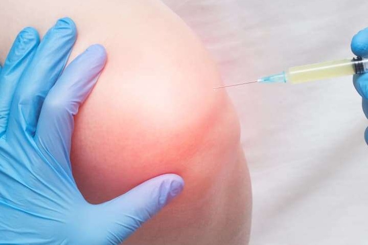 Плазмолифтинг при заболеваниях суставов: преимущества технологии