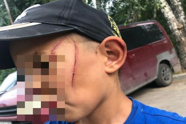 Новосибирца подозревают в избиении семилетнего племянника сожительницы проводом от чайника Новосибирца подозревают в избиении семилетнего племянника сожительницы проводом от чайника