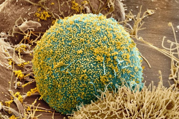 Забайкалье два года не закупало препараты для пациентов с ВИЧ