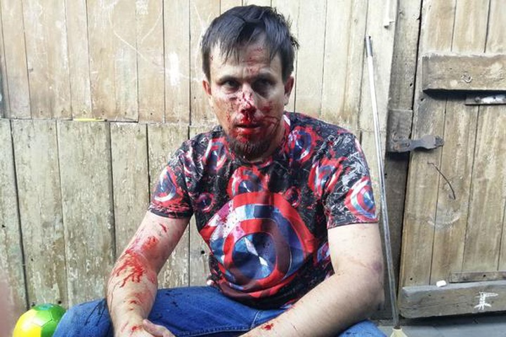 Кузбасского активиста избили, потребовав «не копать» под администрацию