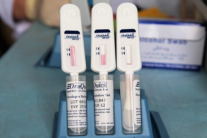 Новосибирцам предложили узнать свой ВИЧ-статус в День памяти умерших от СПИДа Новосибирцам предложили узнать свой ВИЧ-статус в День памяти умерших от СПИДа